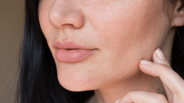 Dry Skin: Causes, Treatments & How to Manage It