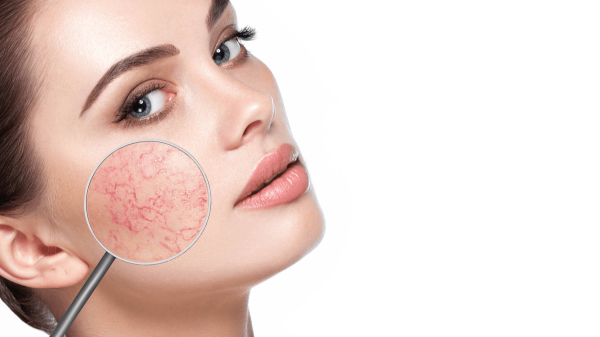 Sensitive Skin: Causes, Treatments & How to Manage It