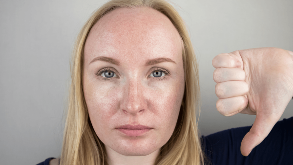 Combination Skin: Causes, Treatments & How to Manage It
